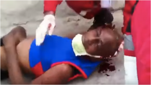 Homem ferido em protestos em Cuba