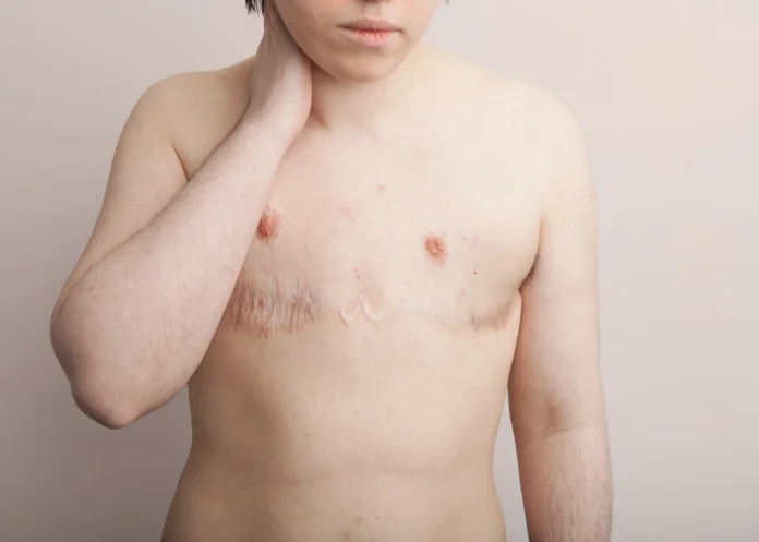 Inglaterra proíbe prescrição de bloqueadores da puberdade para menores 'trans'